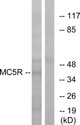 Anti-MC5R antibody (271-320 aa) (STJ94041) – Figure 1 of 1