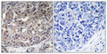 Anti-IFIH1 antibody (976-1025 aa) (STJ94052) – Figure 1 of 1