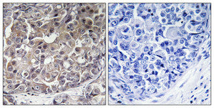 Anti-IFIH1 antibody (976-1025 aa) (STJ94052) – Figure 1 of 1