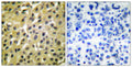 Anti-MDM2 antibody (391-440 aa) (STJ94055) – Figure 1 of 1