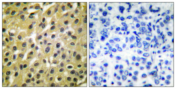 Anti-MDM2 antibody (391-440 aa) (STJ94055) – Figure 1 of 1