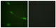 Anti-MDM2 antibody (132-181 aa) (STJ94057) – Figure 1 of 1