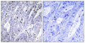 Anti-MEF2D antibody (410-459 aa) (STJ94069) – Figure 1 of 1