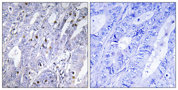 Anti-MEF2D antibody (410-459 aa) (STJ94069) – Figure 1 of 1