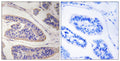 Anti-ENAH antibody (472-521 aa) (STJ94096) – Figure 1 of 1