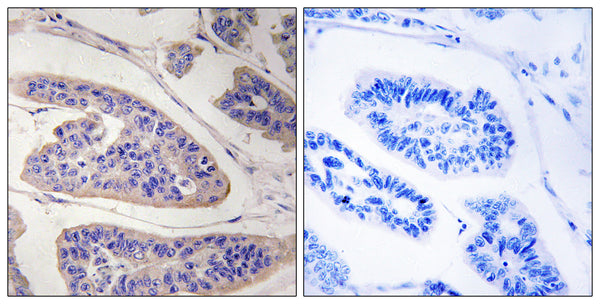 Anti-ENAH antibody (472-521 aa) (STJ94096) – Figure 1 of 1