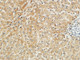 Anti-MET antibody (1316-1365 aa) (STJ94103) – Figure 1 of 1