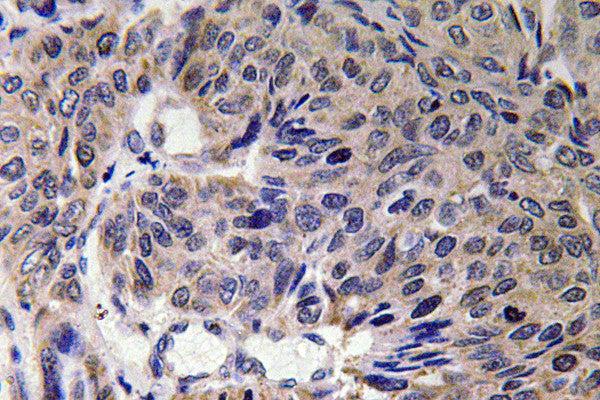 Anti-MFN2 antibody (354-403 aa) (STJ94105) – Figure 1 of 1