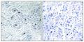 Anti-MINK1 antibody (401-450 aa) (STJ94129) – Figure 1 of 1