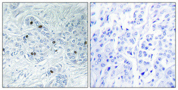 Anti-MINK1 antibody (401-450 aa) (STJ94129) – Figure 1 of 1