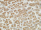 Anti-MITF antibody (151-200) (STJ94134) – Figure 1 of 1