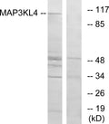 Anti-MAP3K21 antibody (631-680) (STJ94152) – Figure 1 of 1