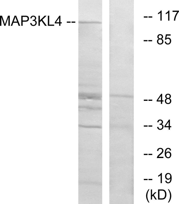 Anti-MAP3K21 antibody (631-680) (STJ94152) – Figure 1 of 1