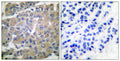 Anti-MMP8 antibody (418-467) (STJ94165) – Figure 1 of 1