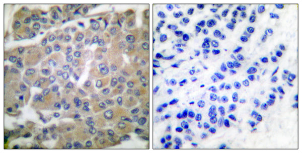Anti-MMP8 antibody (418-467) (STJ94165) – Figure 1 of 1