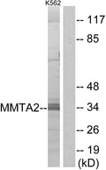 Anti-MMTAG2 antibody (10-59) (STJ94166) – Figure 1 of 1
