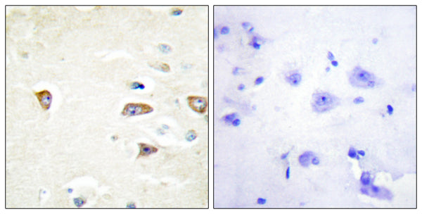 Anti-CDC42BPB antibody (1641-1690) (STJ94193) – Figure 1 of 1