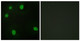 Anti-MORF4L1 antibody (31-80) (STJ94196) – Figure 1 of 1