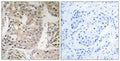 Anti-MRPL41 antibody (81-130) (STJ94228) – Figure 1 of 1