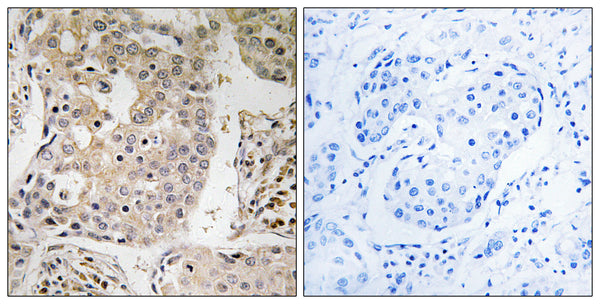 Anti-MRPL41 antibody (81-130) (STJ94228) – Figure 1 of 1