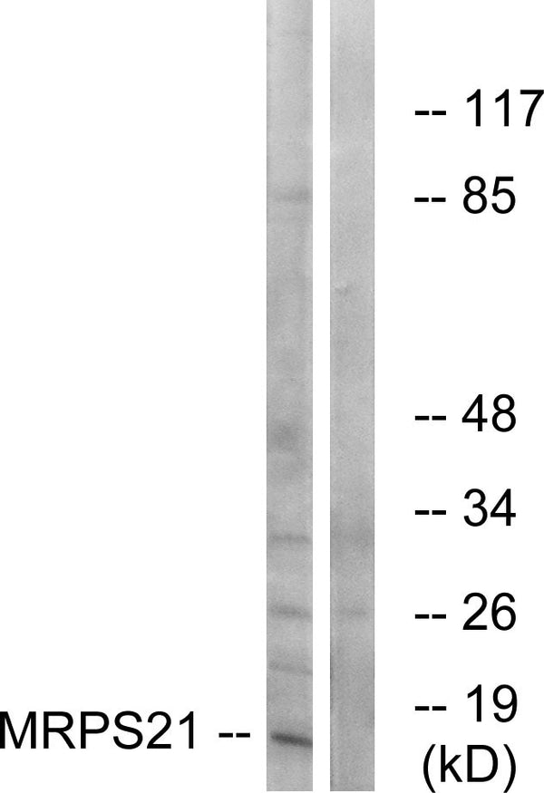 Anti-MRPS21 antibody (38-87) (STJ94245) – Figure 1 of 1