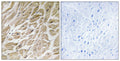 Anti-MRPS24 antibody (51-100) (STJ94247) – Figure 1 of 1