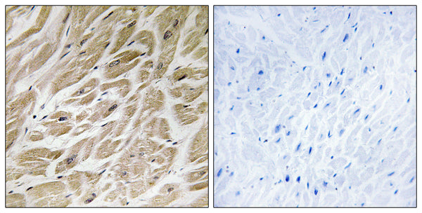 Anti-MRPS24 antibody (51-100) (STJ94247) – Figure 1 of 1