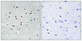 Anti-MRTFA antibody (10-59) (STJ94260) – Figure 1 of 1