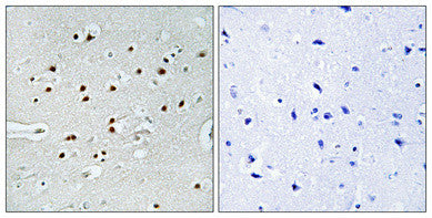 Anti-MRTFA antibody (10-59) (STJ94260) – Figure 1 of 1