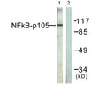 Anti-NFKB1 antibody (896-945) (STJ94463) – Figure 1 of 1