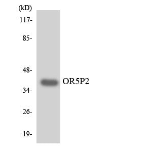 Anti-OR5P2 antibody (193-242) (STJ94781) – Figure 1 of 1