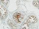 Anti-STMN1 antibody (9-58 aa) (STJ94827) – Figure 1 of 1