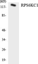 Anti-RPS6KC1 antibody (231-280 aa) (STJ94888) – Figure 1 of 1