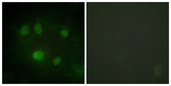 Anti-DDX5 antibody (565-614 aa) (STJ94913) – Figure 1 of 1