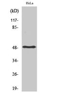 Anti-PDK1 antibody (80-160 aa) (STJ95009) – Figure 1 of 1