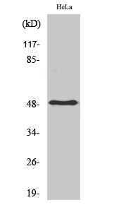 Anti-PDK1 antibody (80-160 aa) (STJ95009) – Figure 1 of 1