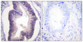 Anti-PFKFB2 antibody (451-500 aa) (STJ95046) – Figure 1 of 1