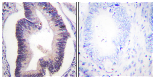 Anti-PFKFB2 antibody (451-500 aa) (STJ95046) – Figure 1 of 1