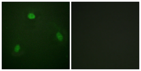 Anti-PIN1 antibody (1-50 aa) (STJ95095) – Figure 1 of 1