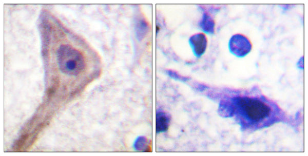 Anti-AKT1S1 antibody (207-256 aa) (STJ95215) – Figure 1 of 1