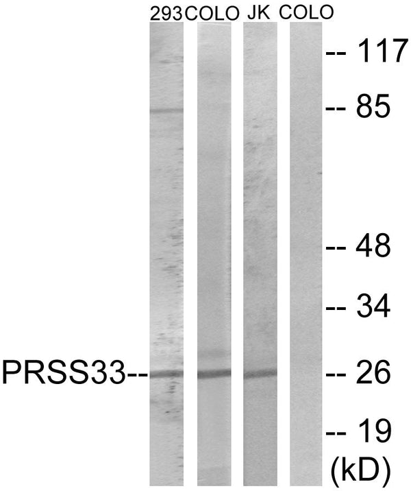 Anti-PRSS33 antibody (18-67 aa) (STJ95236) – Figure 1 of 1