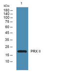 Anti-PRDX2 antibody (C-Term) (STJ95237) – Figure 1 of 1