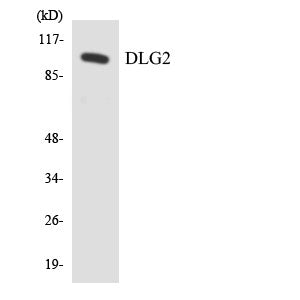 Anti-DLG2 antibody (601-650 aa) (STJ95243) – Figure 1 of 1
