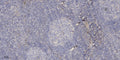 Anti-PSG3 antibody (Internal) (STJ95245) – Figure 1 of 1