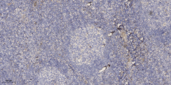 Anti-PSG3 antibody (Internal) (STJ95245) – Figure 1 of 1