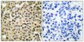 Anti-RAN antibody (167-216 aa) (STJ95363) – Figure 1 of 1
