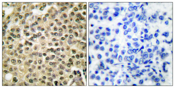 Anti-RAN antibody (167-216 aa) (STJ95363) – Figure 1 of 1