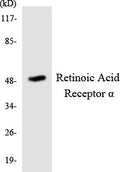 Anti-RARA antibody (46-95 aa) (STJ95372) – Figure 1 of 1