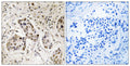 Anti-RCC2 antibody (473-522 aa) (STJ95396) – Figure 1 of 1