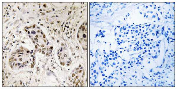Anti-RCC2 antibody (473-522 aa) (STJ95396) – Figure 1 of 1